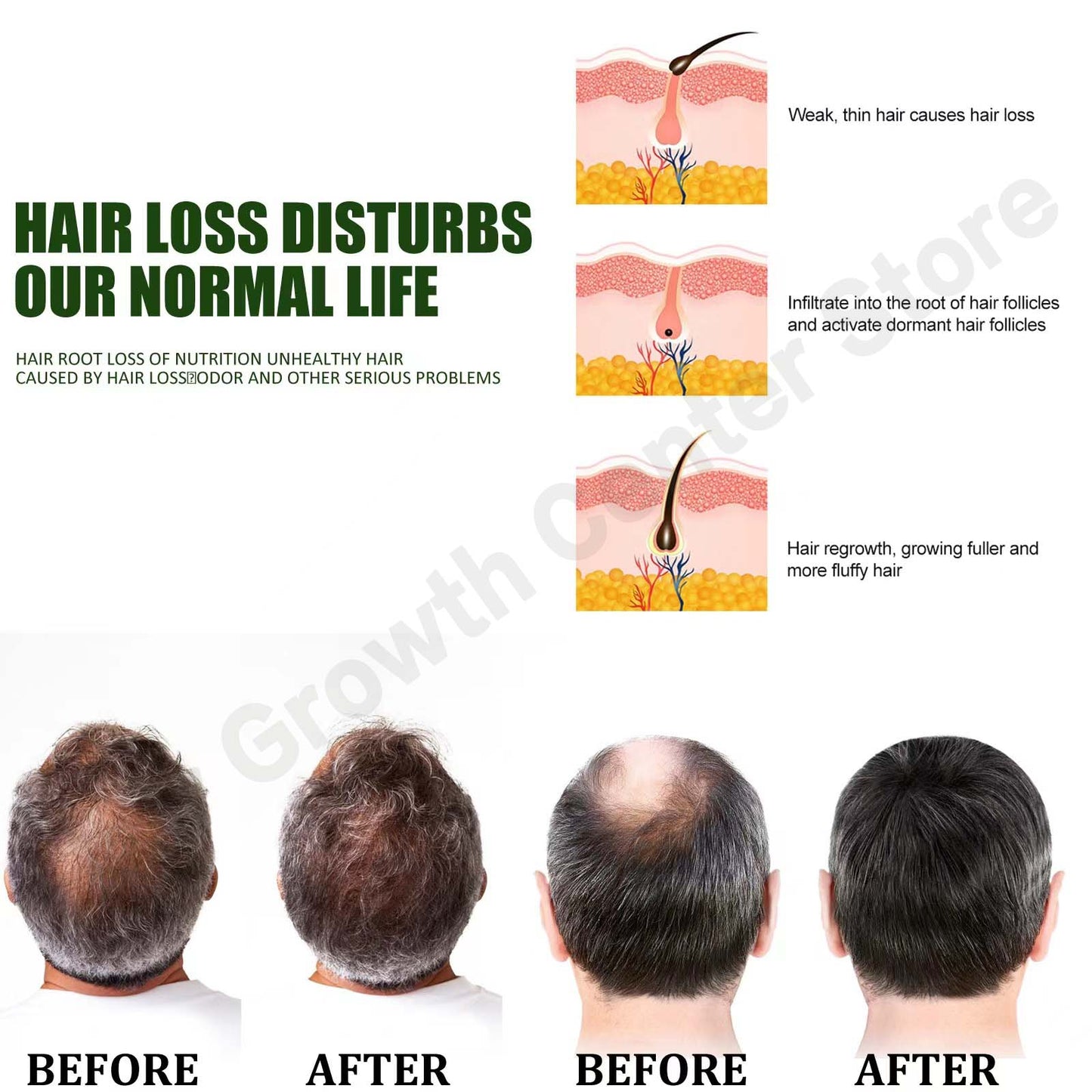 HAIR GROWTH™ Fortalece tu cabello