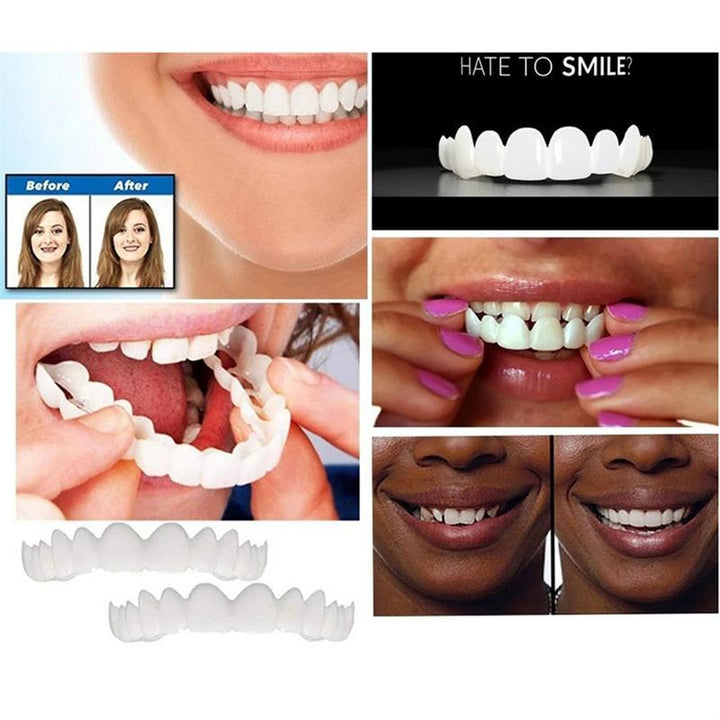 Carillas dentales vuelve a sonreír