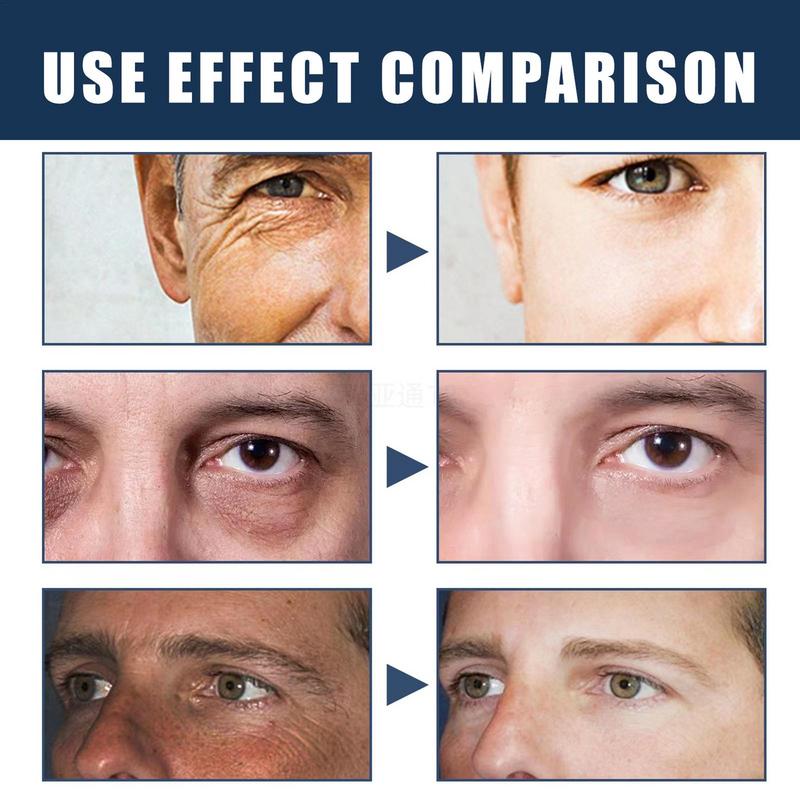 LUNOON™ Crema facial anti cicatrices para hombres