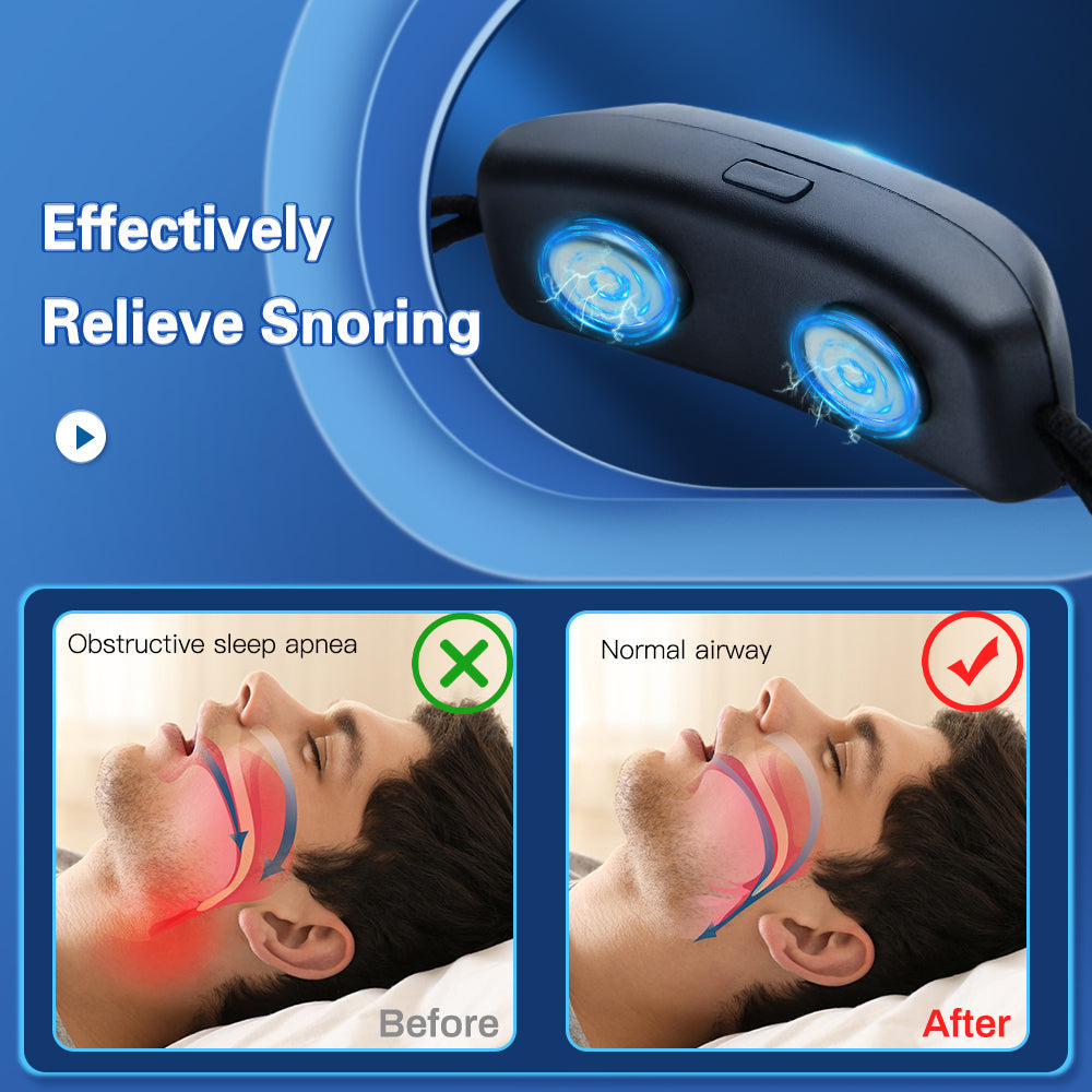 Snoring Device® para los Ronquidos