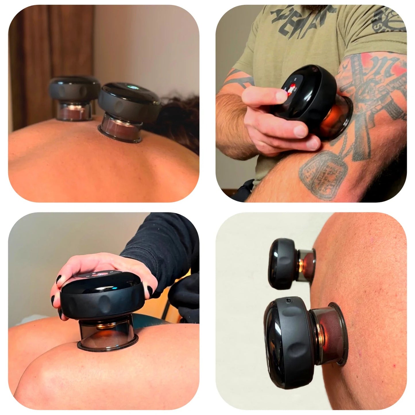 Zenfit™ Terapia de Ventosas